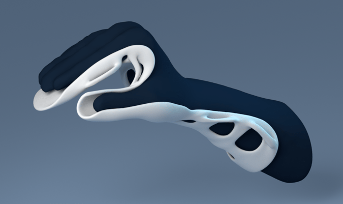 What to do with spasticity?